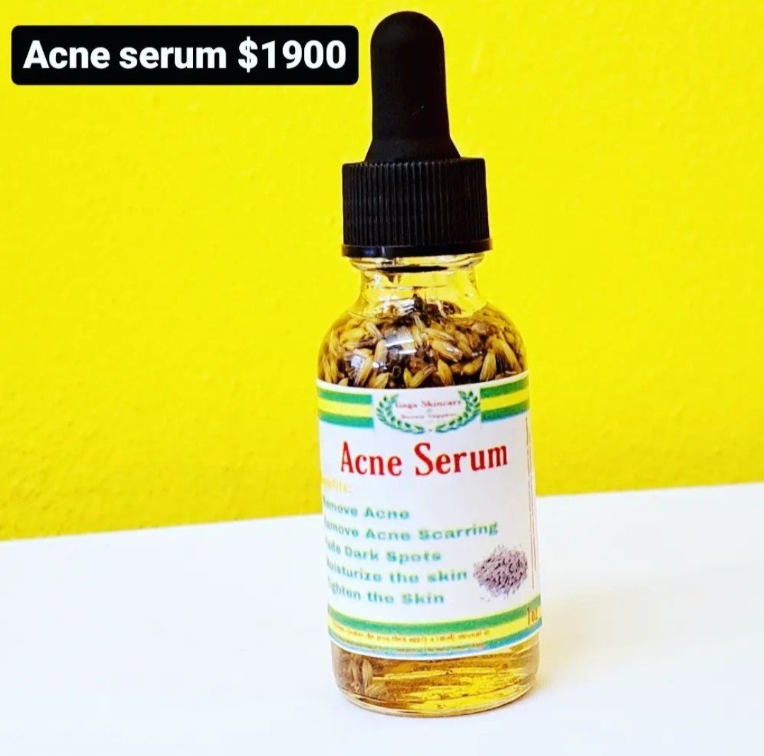 Acne Serum