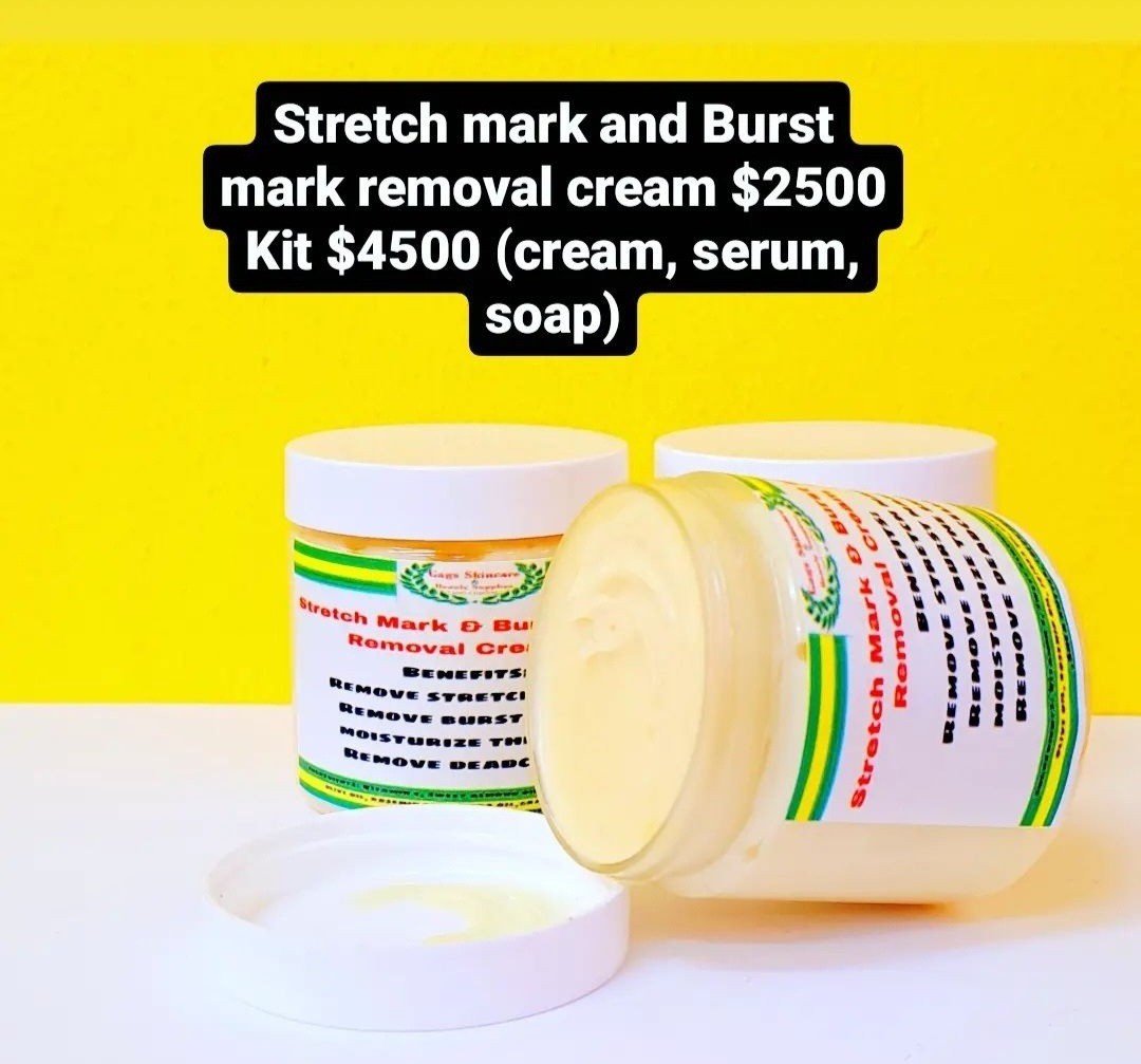 Stretch Mark and Burst mark removal cream