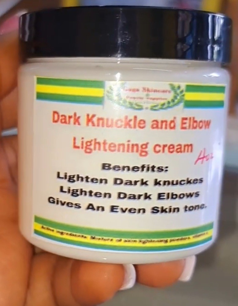 Dark knuckle and elbow lightening cream