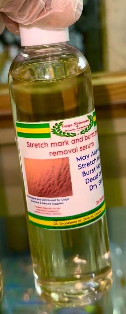 Stretch Mark and Burst Mark Removal Oil