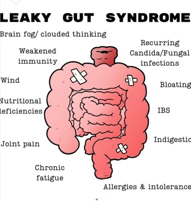 NOW Slippery Elm Capsules (30s)